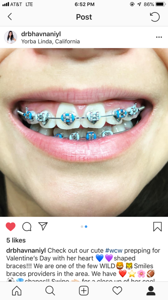 wildsmiles braces embrace your expression designer teeth braces