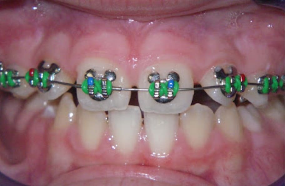 evaluate-brushing-image-1