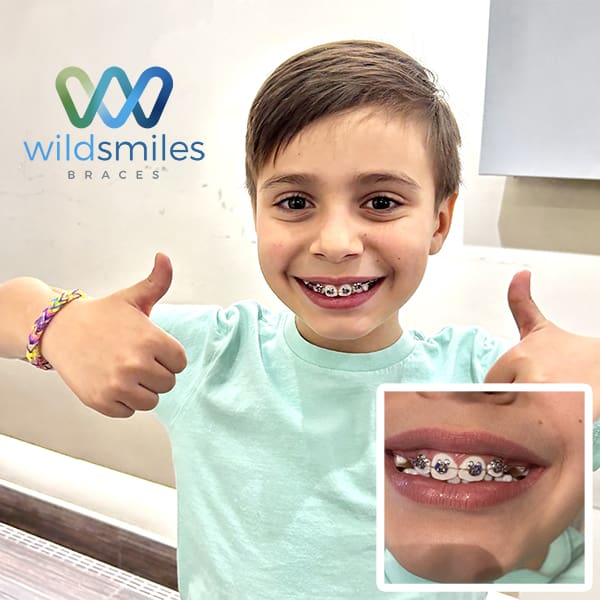 wildsmile-braces-bergen-county-nj